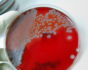 Total Bacteria Count (HPC) for Potable and Non-Potable Water